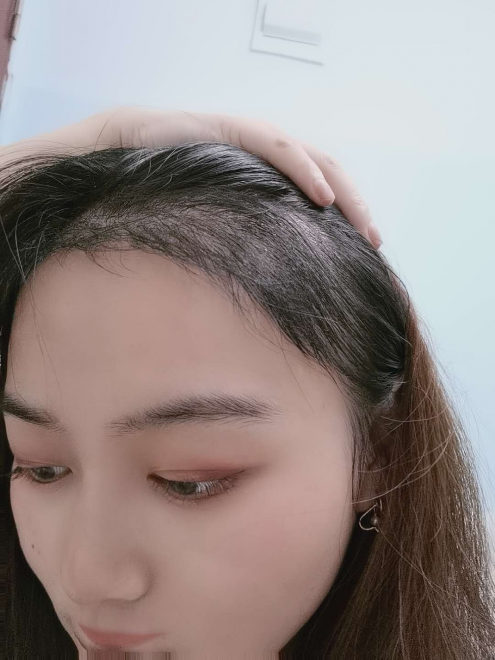 術後3–4個月 術後3–4個月