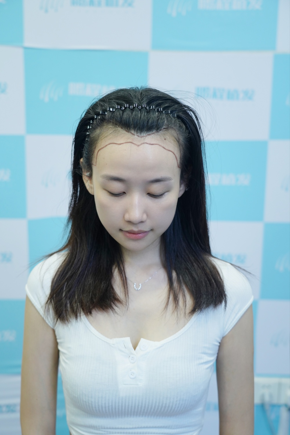 术前设计 术前设计