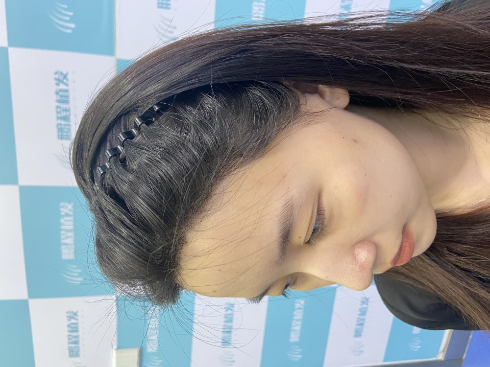 術後7天 術後7天