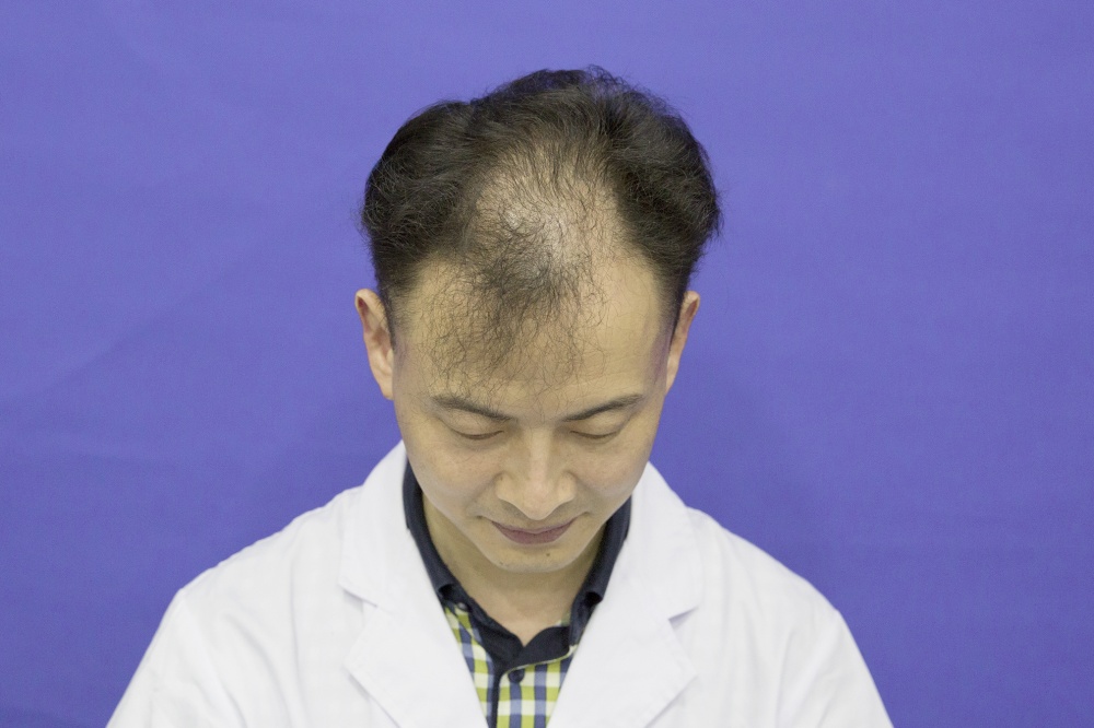 術前狀況 術前狀況