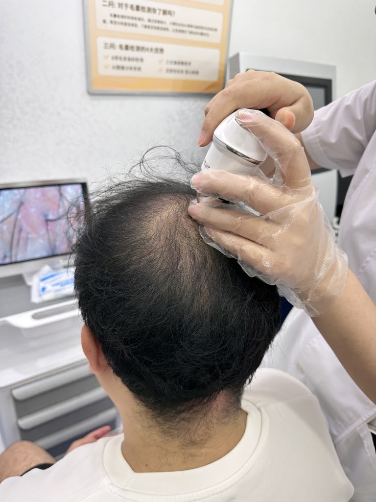毛髮檢測 毛髮檢測