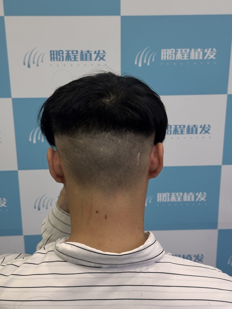 後枕部 後枕部