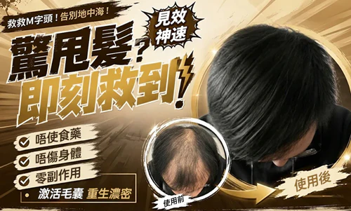 甩頭髮愈嚟愈多？中胚層生髮·唔使食藥一樣生得返